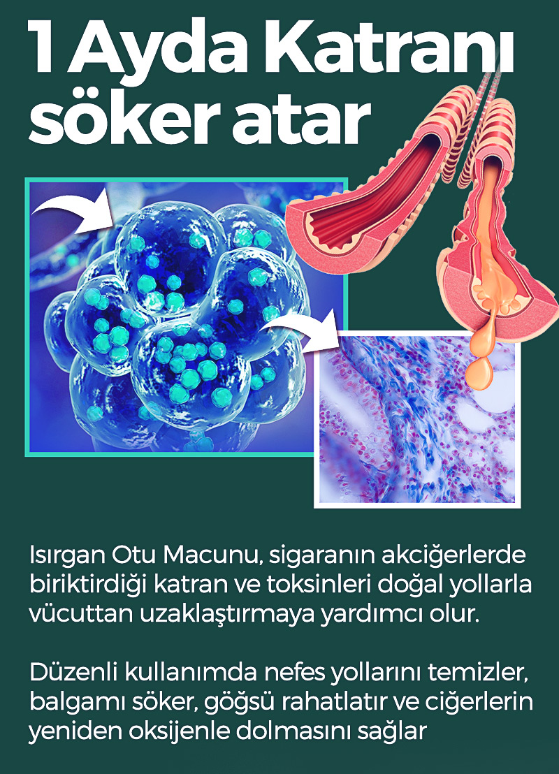 Multi Change Isırgan Otu Macunu